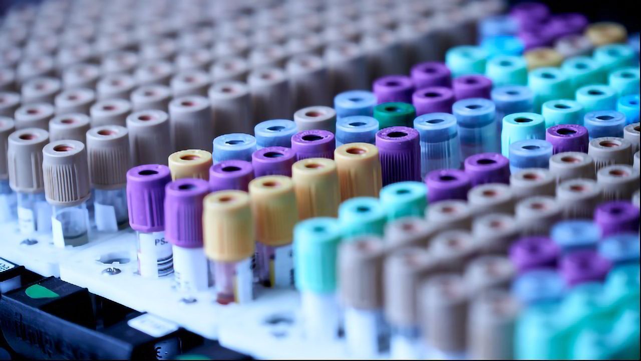 Machine Learning Helps Identify Autism Blood Biomarkers