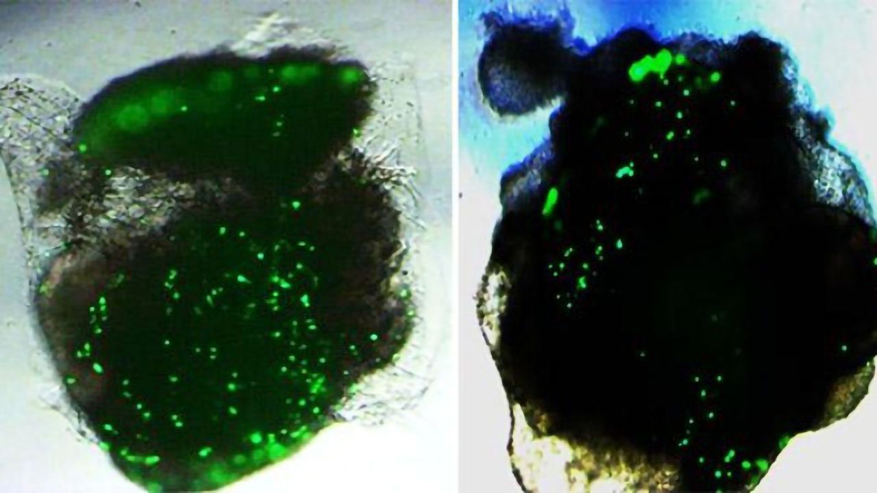 Human Lung and Brain Organoids Respond Differently to SARS-CoV-2 Infection
