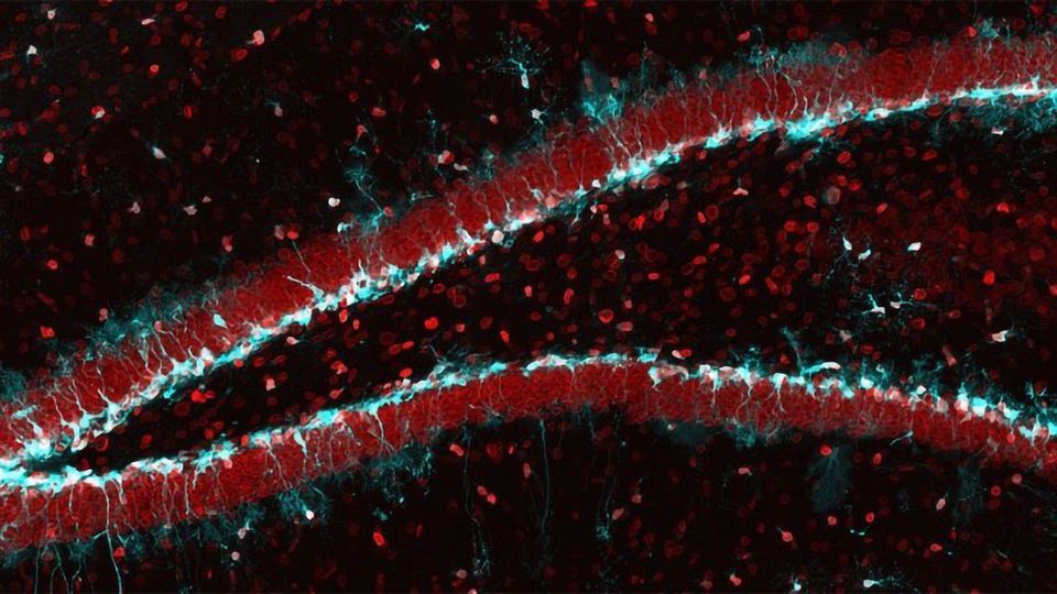 Reactivating Aging Stem Cells in the Brain content piece image