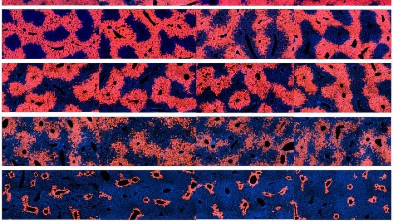 Cells Responsible for Liver Regeneration Identified