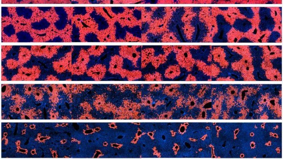 Cells Responsible for Liver Regeneration Identified content piece image