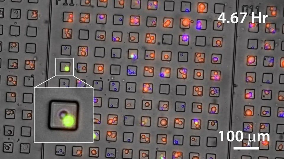 CD4 T Lymphocytes Shown To Kill Cancer Cells Directly content piece image