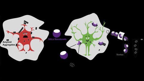 Nanoparticles Help Untangle Alzheimer’s Disease Plaques