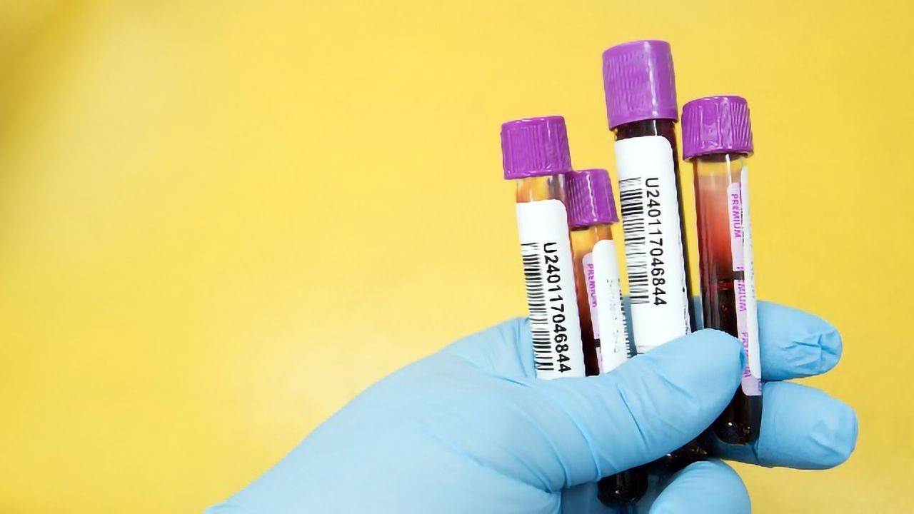 Blood Tests Offer Early Indicator of Severe COVID-19