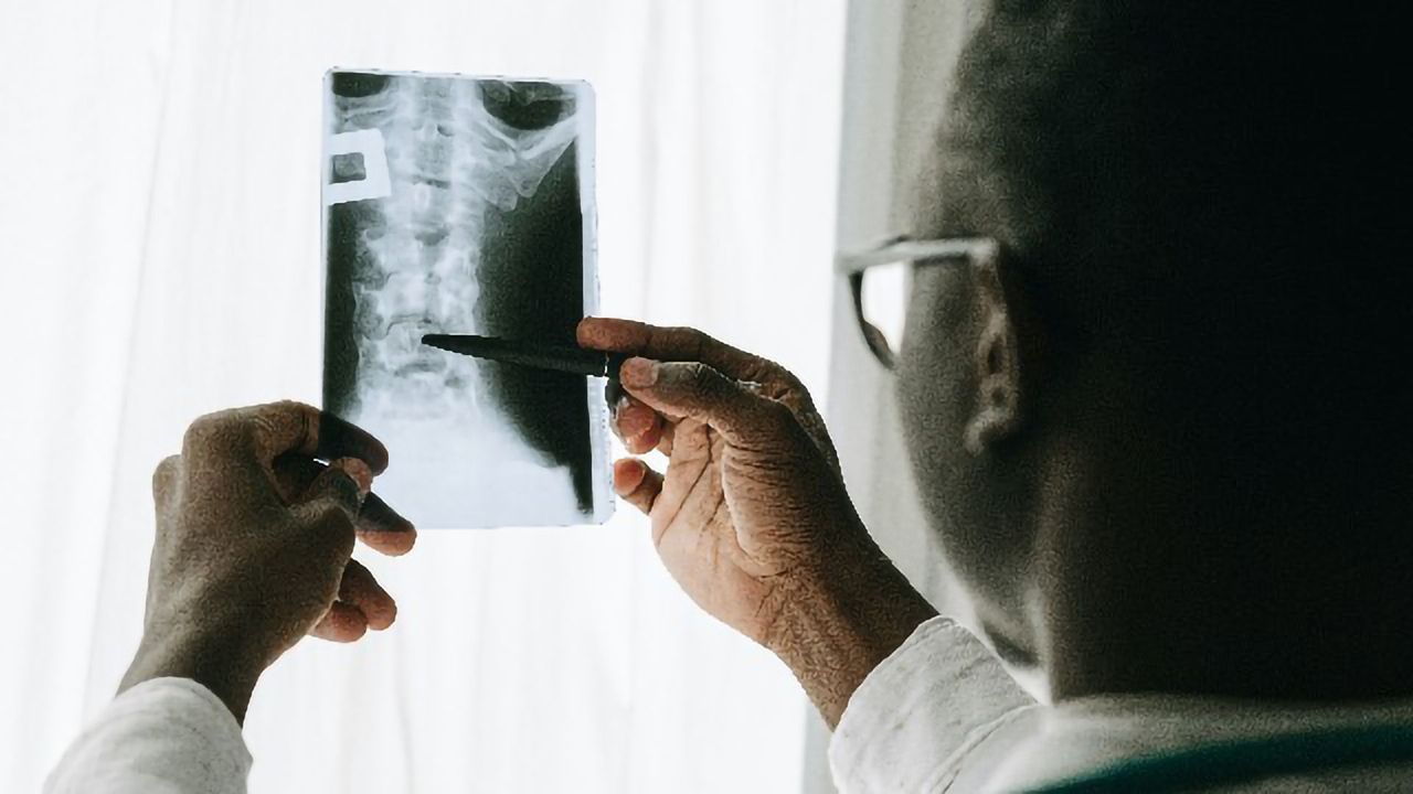 New Type of Bone Cell Identified