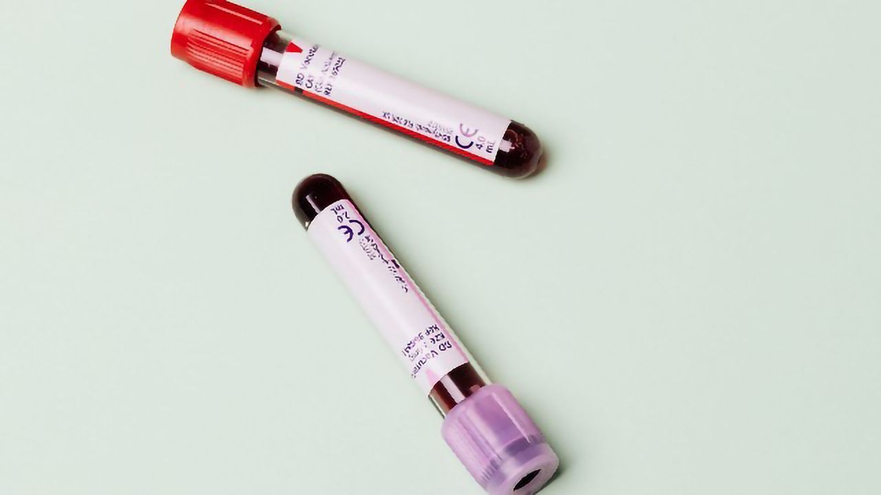 Paving the Way for Personalized Medicine in Sepsis