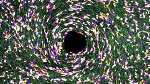 Tissue's Microscopic Geometry Impacts Movement of Malignant Cells
