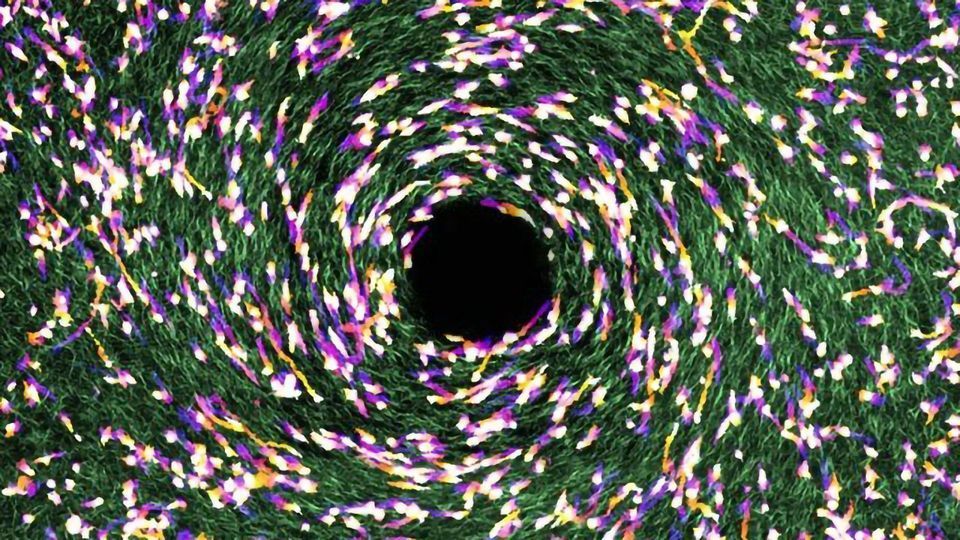Tissue's Microscopic Geometry Impacts Movement of Malignant Cells content piece image