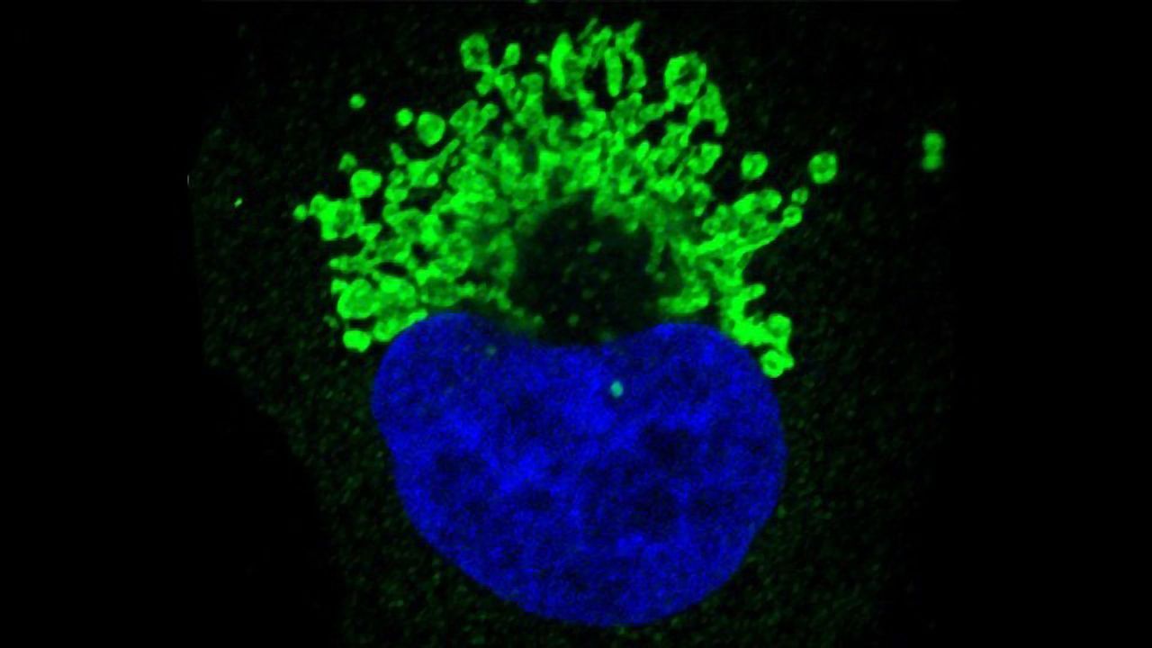 Immunotherapy is Targeted to Alterations in Tumor Suppressor Gene
