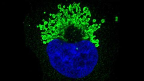 Immunotherapy is Targeted to Alterations in Tumor Suppressor Gene