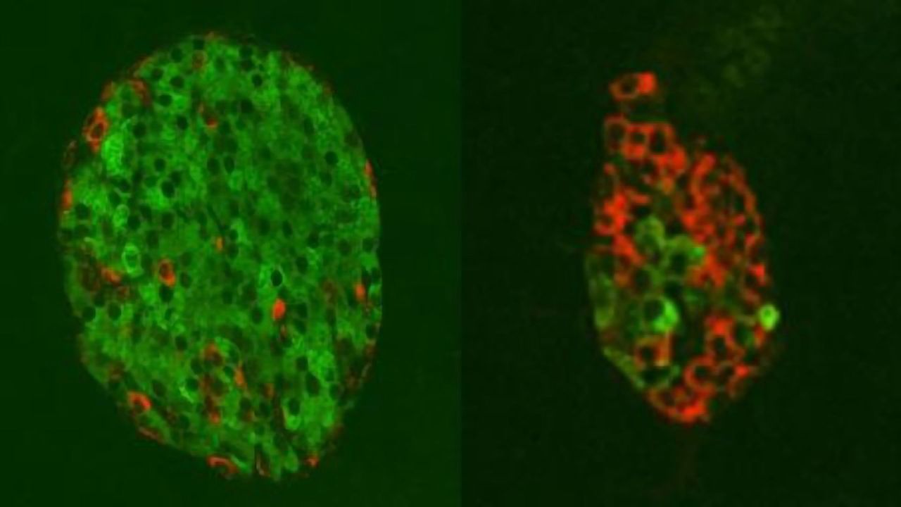 Swapping Alpha Cells for Beta Cells To Treat Diabetes