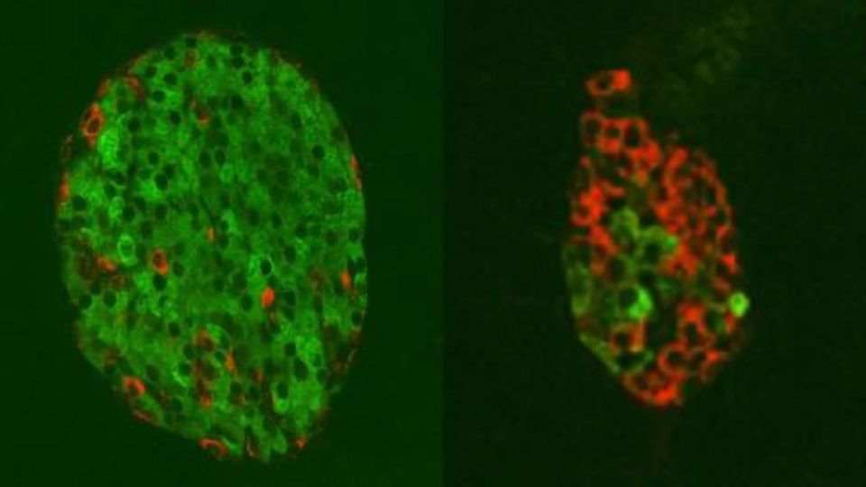 Swapping Alpha Cells for Beta Cells To Treat Diabetes content piece image