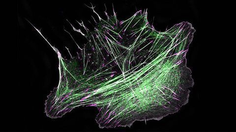 How Cells Build "Mini-Muscles" Underneath Their Nucleus