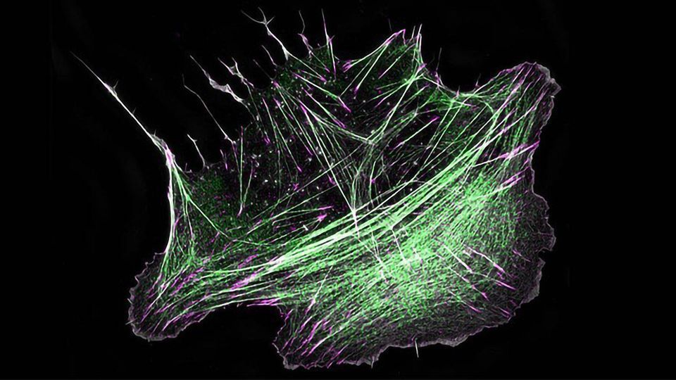How Cells Build "Mini-Muscles" Un­der­neath Their Nuc­leus content piece image
