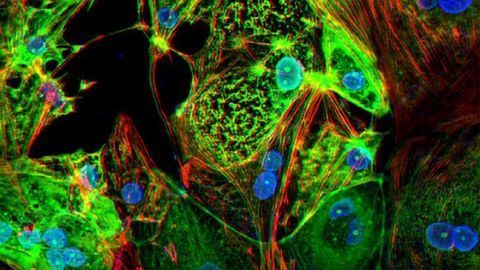 Study Reveals How SARS-CoV-2 Infects Heart Cells