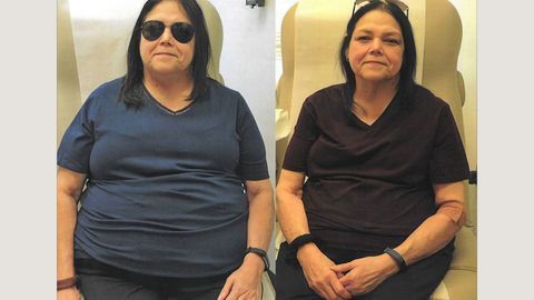 Drug Shown To Help Diabetes Patients Lose Weight in Clinical Study