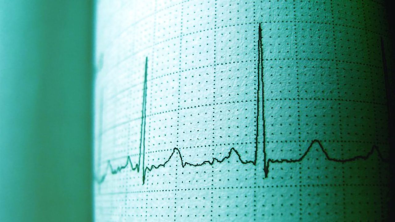 Mechanisms Underlying Exercise-Induced Heart Cell Death Revealed