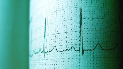 Mechanisms Underlying Exercise-Induced Heart Cell Death Revealed