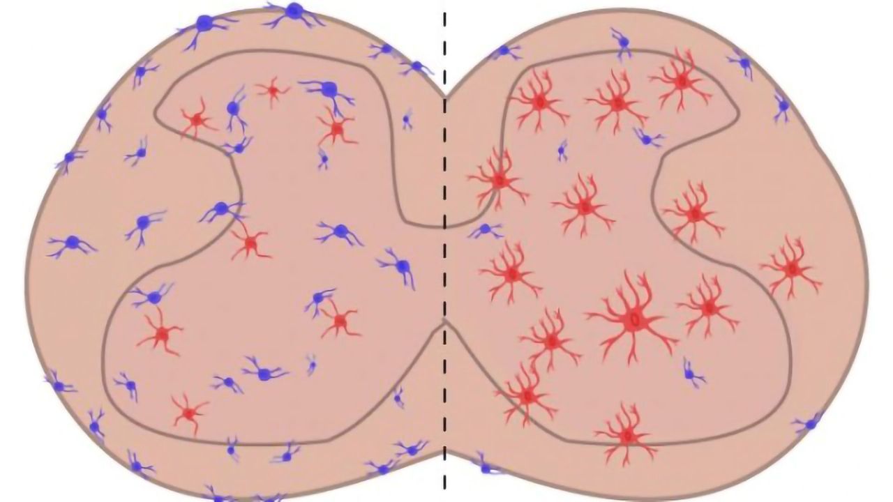 Cell Type Implicated in Chronic Pain Identified