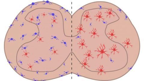 Cell Type Implicated in Chronic Pain Identified
