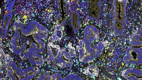 Boosting Radiotherapy Response With Targeted Immunotherapy