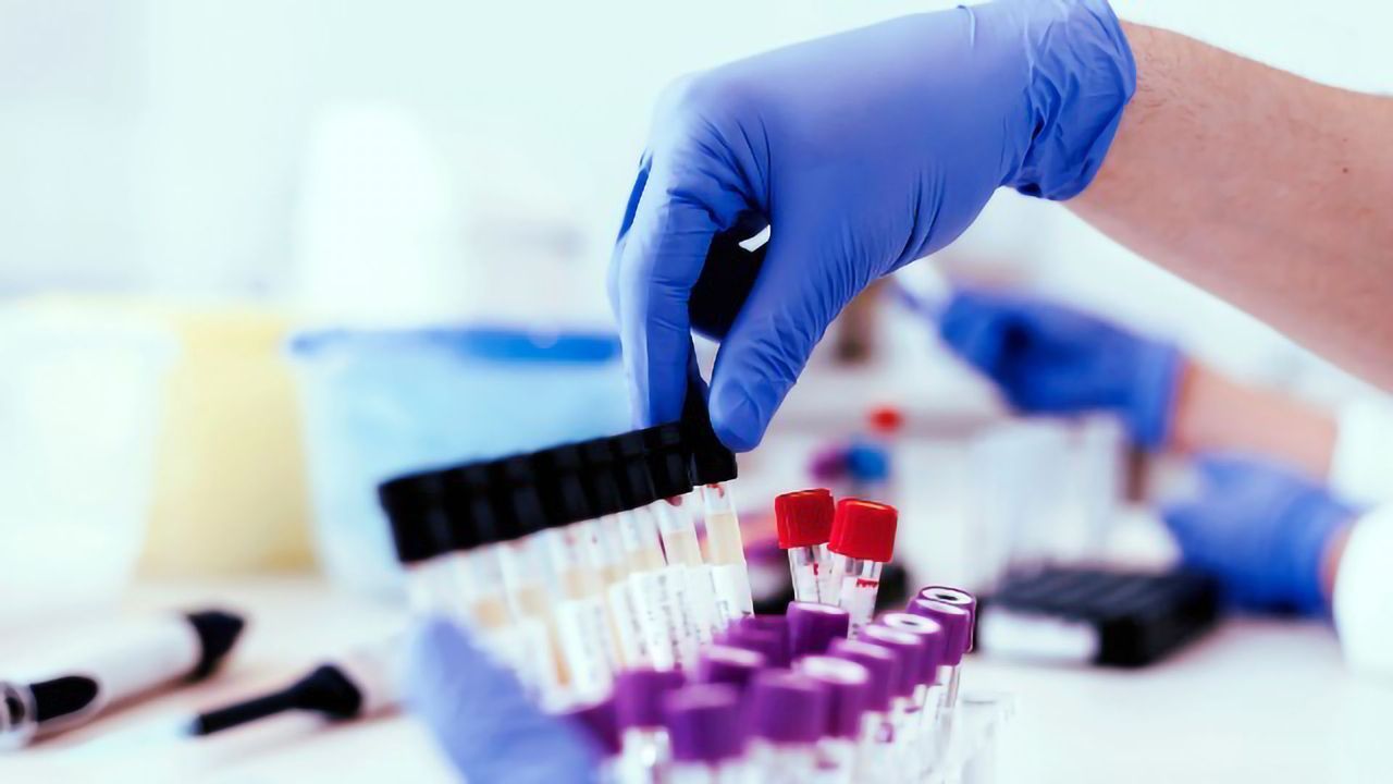Filling in the Blanks of Leading LIMS: A Discussion With LIMS Wizards