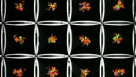 Multicellular Liver-on-a-Chip Models Fatty Liver Disease