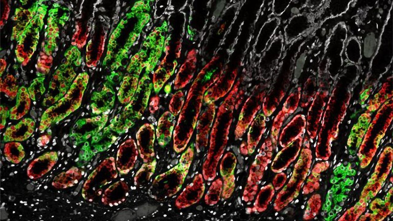 Rare Cell Types in the Upper Gastrointestinal Tract Identified