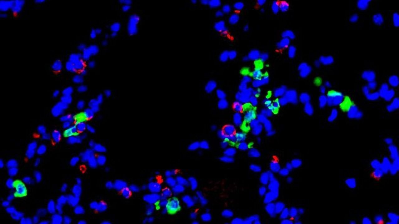 Immune Cell Implicated in Post-Viral Lung Disease