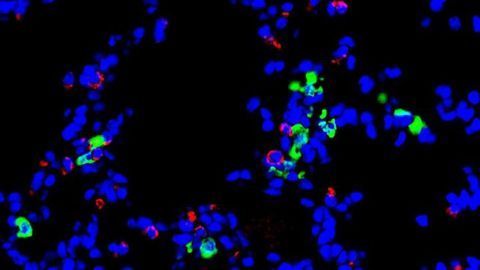 Immune Cell Implicated in Post-Viral Lung Disease