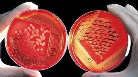 Microbiology - Streptococcus Species