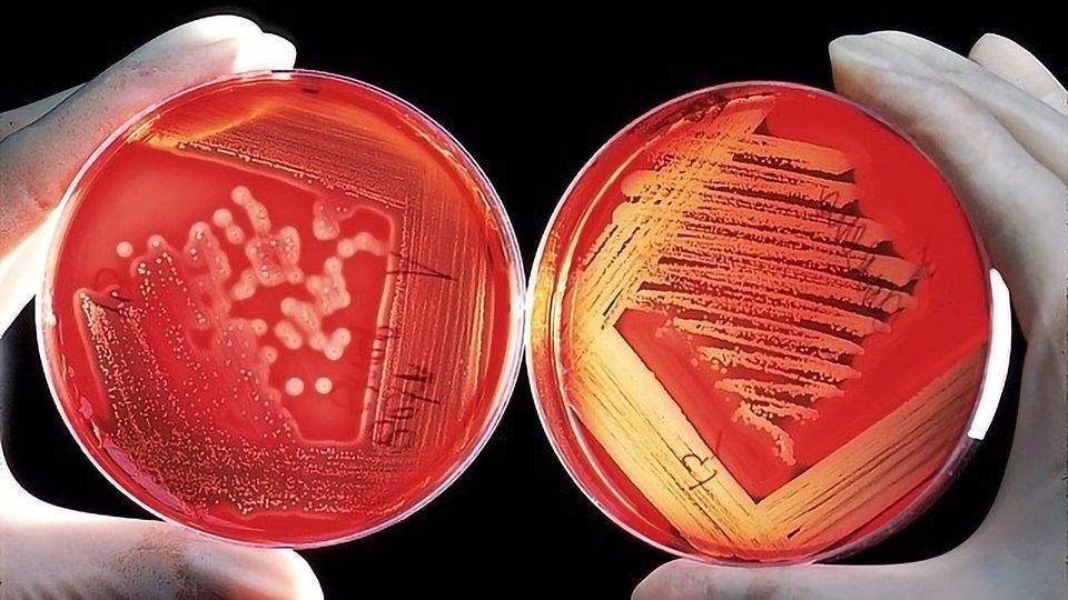 Microbiology - Streptococcus Species content piece image