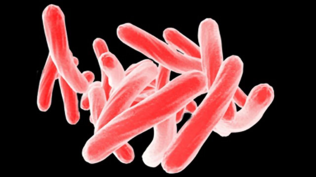 PerkinElmer Completes Acquisition of Oxford Immunotec Global PLC