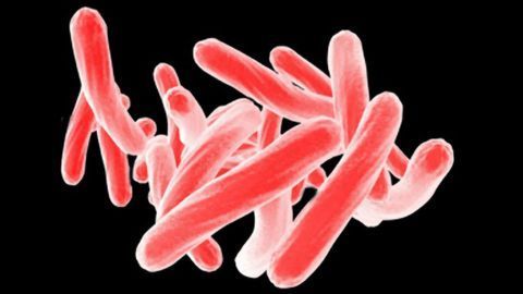 PerkinElmer Completes Acquisition of Oxford Immunotec Global PLC