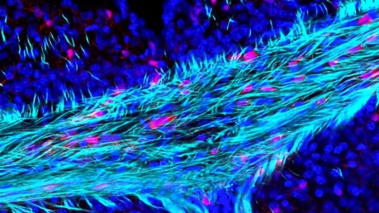 Loss of Brain's "Wiring Insulation" Linked to Neurodegeneration