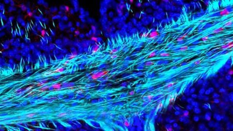 Loss of Brain's "Wiring Insulation" Linked to Neurodegeneration