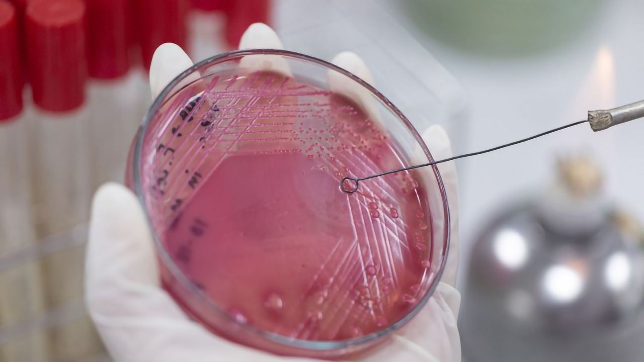How Can Artificial Intelligence Stop the Spread of Antimicrobial Resistance?