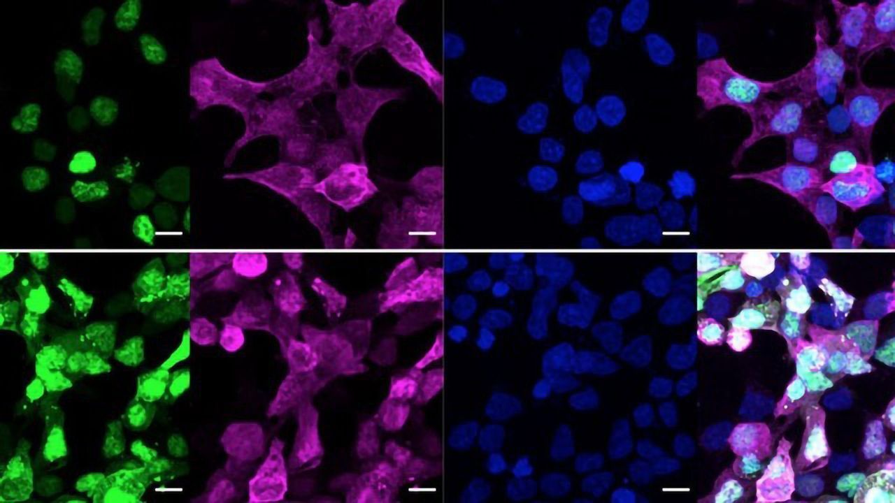 Highly-Selective Tool Developed To Study "Undruggable" Proteins