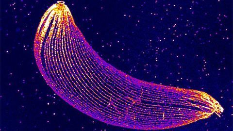 Malaria Parasite's Cytoskeleton Reveals Its Secrets