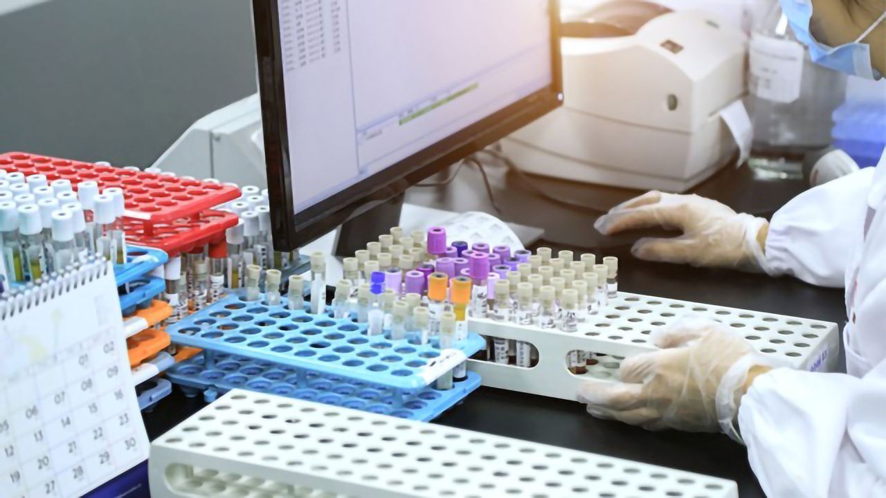 Considerations When Selecting a LIMS