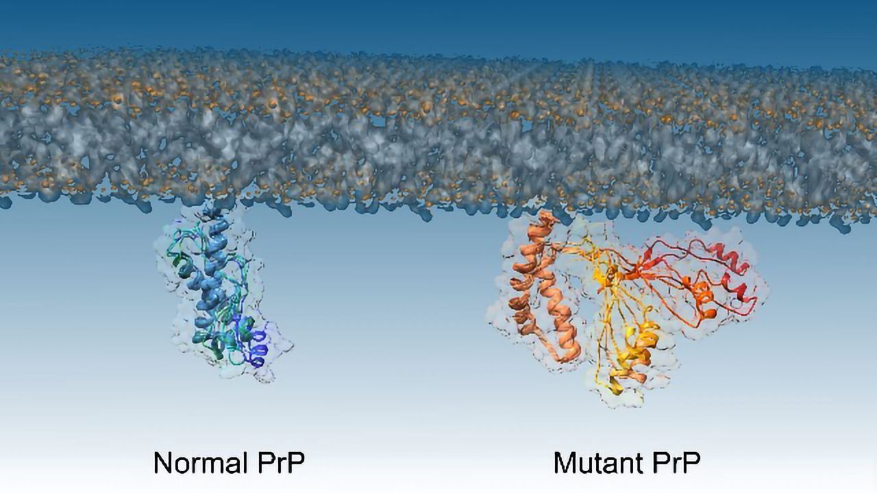 Protein Discovery Reveals Mechanism of Fatal Prion Brain Diseases
