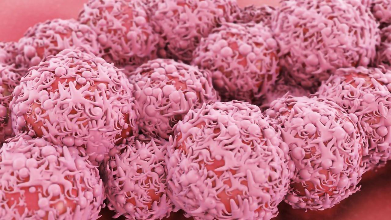 Mutant Enzyme Is a Main Driver of Lung Cancer