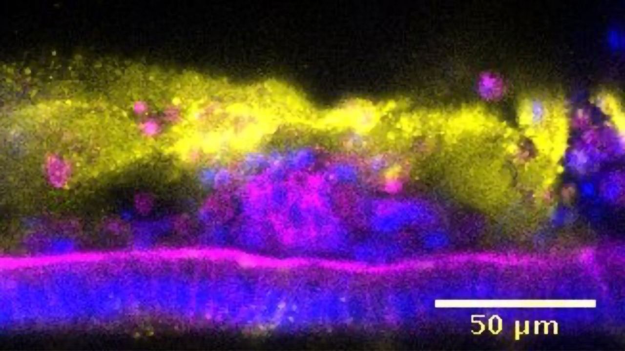 Taking a Closer Look at Microbial Friends and Foes With Intestine-on-a-Chip