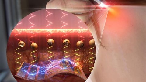 Light-Triggered Drug Delivery