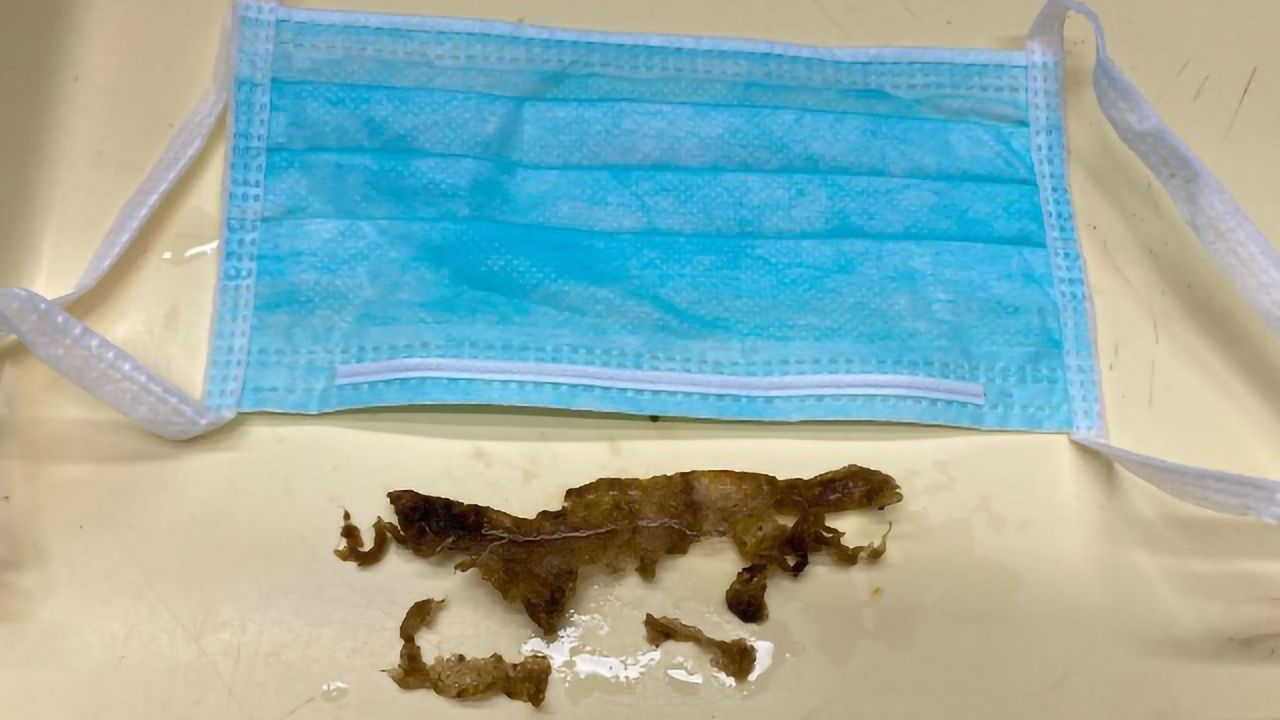 Face Masks Are Leaving an Environmental and Archaeological Mark
