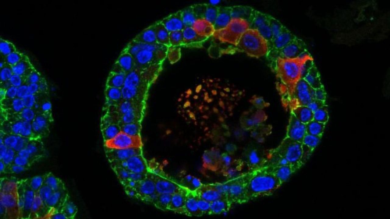 Crying Human Tear Glands Grown in the Lab