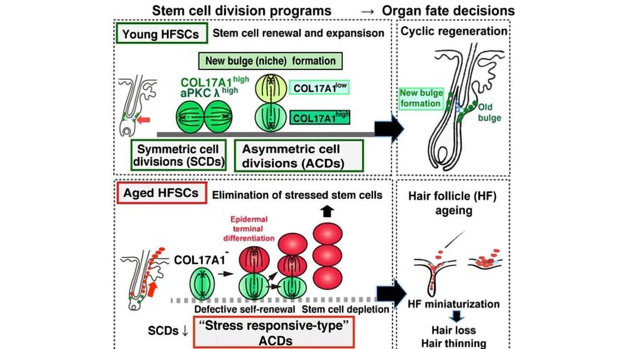 Novel Mechanism Underlying Hair Thinning Identified