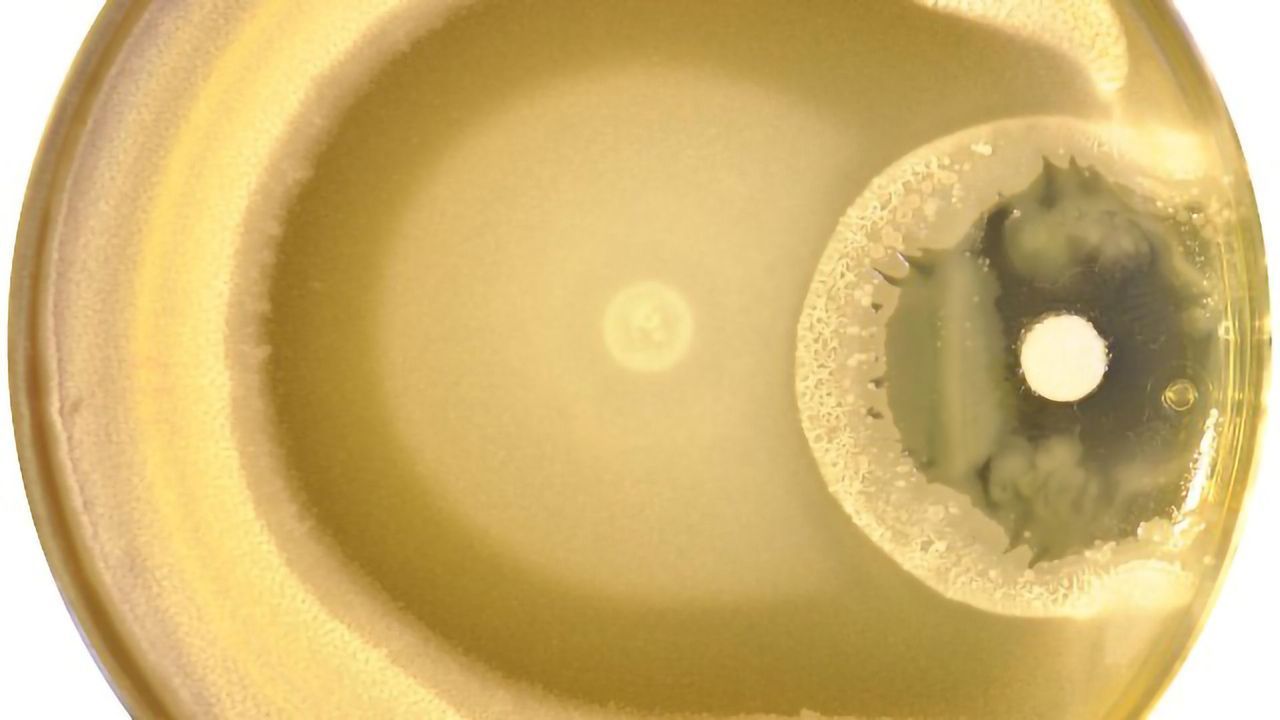 Bacterial Traffic Jams Linked to Antibiotic Resistance Development