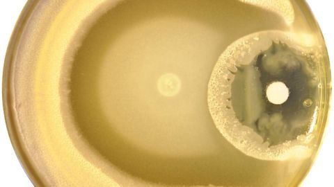 Bacterial Traffic Jams Linked to Antibiotic Resistance Development
