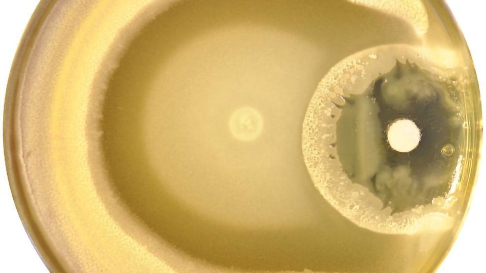 Bacterial Traffic Jams Linked to Antibiotic Resistance Development content piece image